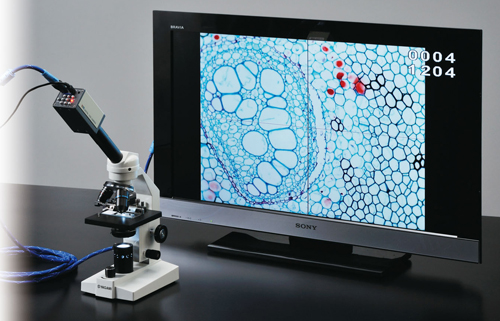 デジタル顕微鏡テレビ装置